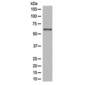 Western blot testing of human JAR cell lysate with NOX4 antibody at 0.5ug/ml. Expected molecular weight: ~65 kDa, 75-80 kDa.