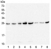 Western blot testing of 1) human HeLa, 2) human T-47D, 3) rat brain, 4) rat lung, 5) rat stomach, 6) mouse lung, 7) mouse stomach and 8) mouse kidney lysate with GSTM1 antibody at 0.5ug/ml. Predicted molecular weight ~26 kDa.