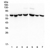 Western blot testing of human 1) HeLa, 2) MBA-MD-231, 3) COLO-320, 4) PANC-1, 5) HT180, 6) MBA-MD-453 and 7) HepG2 lysate with HSPA2 antibody at 0.5ug/ml. Expected molecular weight ~70 kDa.
