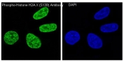 Immunofluorescent staining of human HeLa cells treated and untreated with H2O2 using phospho-Histone H2AX antibody (green) and DAPI nuclear stain (blue).