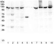 Western blot testing of 1) rat liver, 2) rat lung, 3) mouse liver, 4) mouse lung, 5) rabbit IgG, 6) molecular weight marker, 7) human HepG2, 8) human SMMC-7721, 9) human HeLa and 10) human Jurkat lysate with XPO1 antibody at 0.5ug/ml. Expected molecular weight ~123 kDa.