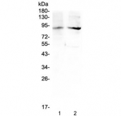 Western blot testing of 1) rat testis and 2) mouse testis lysate with XPB antibody at 0.5ug/ml. Predicted molecular weight ~89 kDa.