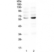 Western blot testing of human 1) K562 and 2) MDA-MB-231 lysate with NRF1 antibody at 0.5ug/ml. Expected molecular weight: isoforms from 45-67 kDa.