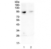 Western blot testing of human 1) MDA-MB-231 and 2) Jurkat lysate with RASAL1 antibody at 0.5ug/ml. Predicted molecular weight ~90 kDa.
