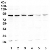Western blot testing of human 1) Raji, 2) MCF7, 3) placenta, 4) A549, 5) Caco-2 and 6) U-2 OS lysate with Bcl6 antibody at 0.5ug/ml. Predicted molecular weight: 78~100 kDa.
