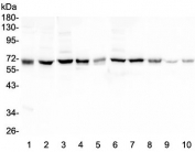Western blot testing of 1) human SHG-44, 2) human ThP-1, 3) rat brain, 4) rat smooth muscle, 5) rat ovary, 6) mouse brain, 7) mouse smooth muscle, 8) mouse ovary, 9) mouse small intestine and 10) mouse Neuro-2a lysate with HAS1 antibody at 0.5ug/ml. Predicted molecular weight ~63 kDa.