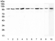 Western blot testing of human 1) placenta, 2) HL-60, 3) 22RV1, 4) 293T, 5) PANC-1, 6) SGC-7901, 7) Caco-2, 8) PC-3, 9) rat brain and 10) mouse brain lysate with Plasminogen antibody at 0.5ug/ml. Predicted molecular weight ~92 kDa, may be observed at higher molecular weights due to glycosylation.