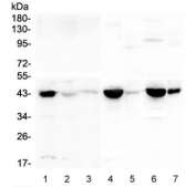 Western blot testing of 1) human K562, 2) human CNE, 3) human COLO-320, 4) rat heart, 5) rat lung, 6) mouse heart and 7) mouse lung lysate with CKM antibody at 0.5ug/ml. Predicted molecular weight ~43 kDa.