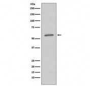 Western blot testing of human A431 cell lysate with SGK1 antibody.