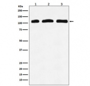 Western blot testing of 1) human K562, 2) mouse RAW264 and 3) rat kidney lysate with PIK3CD antibody. Expected molecular weight: 110-120 kDa.