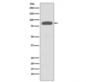 Western blot testing of human A431 cell lysate with IKK alpha/beta antibody. Predicted molecular weight ~85 kDa.