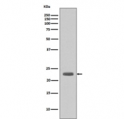 Western blot testing of human A431 cell lysate with BCL2L11 antibody. Predicted molecular weight: 12-22 kDa (three isoforms).