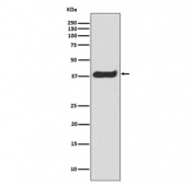 Western blot testing of human Jurkat lysate with phospho-LAT antibody. Expected molecular weight: 36-38 kDa.