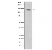 Western blot testing of human HeLa cell lysate with Rad21 antibody. Expected molecular weight: ~120 kDa (full length), 64-70 kDa (cleavage product).