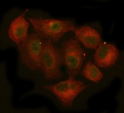 Immunofluorescent staining of FFPE human A549 cells with JAK2 antibody (green) and Beta Tubulin antibody (red). HIER: steam section in pH6 citrate buffer for 20 min.