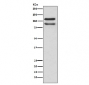 Western blot testing of human HeLa cell lysate with p120 Catenin antibody. Predicted molecular weight of isoform 1: 102-108 kDa and isoform 2: 95-102 kDa.