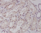 IHC staining of FFPE human kidney tissue with MAF antibody. HIER: boil tissue sections in pH6, 10mM citrate buffer, for 10-20 min and allow to cool before testing.