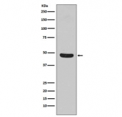 Western blot testing of human HeLa cell lysate with Flotillin 1 antibody. Predicted molecular weight ~49 kDa.