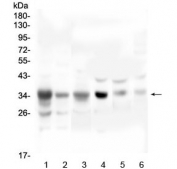 Western blot testing of 1) human A549, 2) human U-2 OS, 3) human PC-3, 4) rat heart, 5) mouse heart and 6) mouse HEPA1-6 lysate wtih SFRP1 antibody at 0.5ug/ml. Predicted molecular weight ~35 kDa.