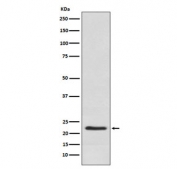 Western blot testing of human placental lysate with CSH1 antibody. Predicted molecular weight ~25 kDa.