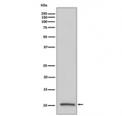 Western blot testing of human serum lysate with IGF2 antibody. Circulating IGF2 has an observed molecular weight of 10-18 kDa.