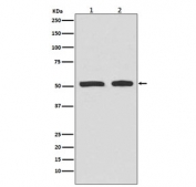 Western blot testing of lysate from human 1) HepG2 and 2) HeLa cells treated with etoposide, with phospho-TP53 antibody (pS9). Predicted molecular weight ~53 kDa.
