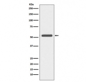 Western blot testing of human A431 cell lysate with Cytokeratin 6 antibody. Predicted molecular weight ~56 kDa.