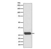 Western blot testing of human fetal brain lysate with THY1 antibody. Expected molecular weight 18~35 kDa depending on glycosylation level.