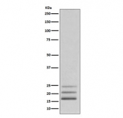 Western blot testing of human K562 cell lysate with FGF2 antibody. Predicted molecular weight: 17-31 kDa (multiple isoforms).
