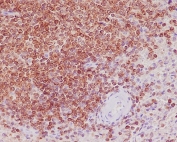 IHC staining of FFPE human spleen tissue with Bcl-2 antibody. HIER: boil tissue sections in pH6, 10mM citrate buffer, for 10-20 min and allow to cool before testing.
