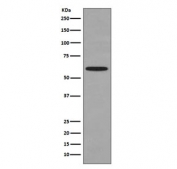 Western blot testing of human HeLa cell lysate with HSPD1 antibody. Predicted molecular weight ~60 kDa.