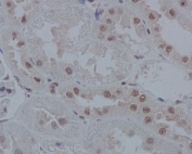 IHC staining of FFPE rat kidney tissue with IRF1 antibody. HIER: boil tissue sections in pH6, 10mM citrate buffer, for 10-20 min and allow to cool before testing.
