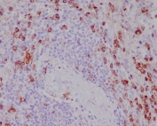 IHC staining of FFPE human spleen tissue with CD11b antibody. HIER: boil tissue sections in pH6, 10mM citrate buffer, for 10-20 min followed by cooling at RT for 20 min.