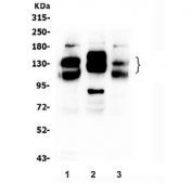 Western blot testing of 1) rat brain, 2) rat C6 and 3) mouse brain lysate with NCAM1 antibody. Predicted molecular weight: ~110 kDa (soluble fragment), ~120/125 kDa (GPI-anchored), 140/180 kDa (transmembrane isoforms).
