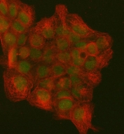 Immunofluorescent staining of FFPE human A431 cells with PCNA antibody (green) and Beta Tubulin mAb (red). HIER: steam section in pH6 citrate buffer for 20 min.