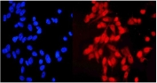 Immunofluorescent staining of FFPE human U-2 OS cells with NDC80 antibody (red) and DAPI nuclear stain (blue). HIER: steam section in pH6 citrate buffer for 20 min.