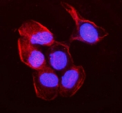 Immunofluorescent staining of FFPE human A431 cells with MYH10 antibody (red) and DAPI nuclear stain (blue). HIER: steam section in pH6 citrate buffer for 20 min.