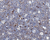 IHC staining of FFPE human tonsil with NCF2 antibody. HIER: boil tissue sections in pH8 EDTA for 20 min and allow to cool before testing.