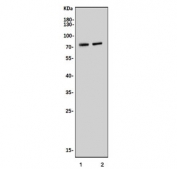 Western blot testing of 1) rat liver and 2) mouse liver tissue lysate with Narc1 antibody. Predicted molecular weight ~74 kDa (pro form).