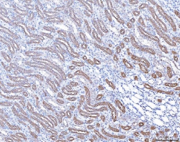 IHC staining of FFPE rat kidney tissue with ACP3 antibody. HIER: boil tissue sections in pH8 EDTA for 20 min and allow to cool before testing.