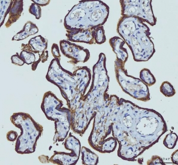 IHC staining of FFPE human placental tissue with HRS antibody. HIER: boil tissue sections in pH8 EDTA for 20 min and allow to cool before testing.
