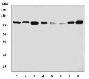 Western blot testing of 1) human HeLa, 2) human 293T, 3) human K562, 4) human SK-O-V3, 5) rat brain, 6) rat PC-12, 7) mouse brain and 8) mouse NIH 3T3 cell lysate with HRS antibody. Predicted molecular weight ~86 kDa, commonly observed at 110-115 kDa.