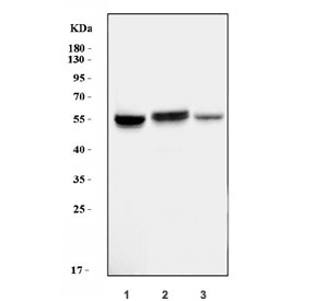 Western blot testing of human 1) HepG2, 2) HCCP and 3) ThP-1 cell lysate with AGT antibody. Predicted molecular weight ~56 kDa.