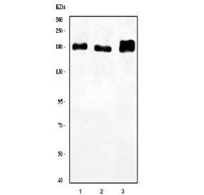 Western blot testing of 1) human HEL, 2) human K562 and 3) rat brain lysate with LARG antibody. Predicted molecular weight ~173 kDa but commonly observed at up to 220 kDa, possibly due to phosphorylation.~