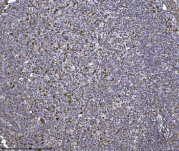 IHC staining of FFPE human tonsil tissue with SCA2 antibody. HIER: boil tissue sections in pH8 EDTA for 20 min and allow to cool before testing.