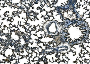 IHC staining of FFPE rat lung tissue with Ccl21a antibody. HIER: boil tissue sections in pH8 EDTA for 20 min and allow to cool before testing.~