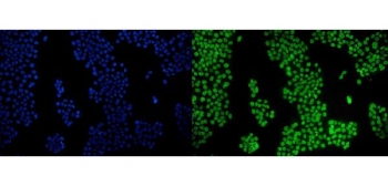 Immunofluorescent staining of FFPE human A431 cells with PPARG antibody (green) and DAPI nuclear stain (blue). HIER: steam section in pH6 citrate buffer for 20 min.