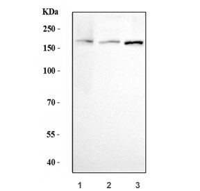 Western blot testing of 1) human HepG2, 2) rat brain and 3) mouse brain lys