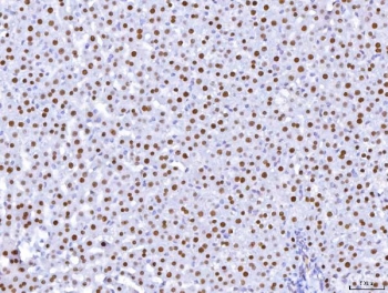 IHC staining of FFPE rat liver tissue with HNF4A antibody. HIER: boil tissue sections in pH8 EDTA for 20 min and allow to cool before testing.