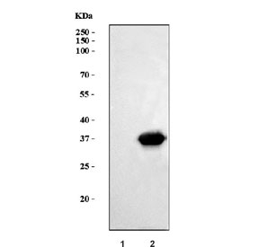 Western blot testing of human 1) Jurkat and 2) Raji cell lysate with CD20 antibody. Predicted molecular weight ~33 kDa.